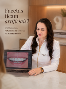 Dra. Clarissa Freitas planejando facetas de porcelana naturais em Campinas para evitar sorriso artificial.