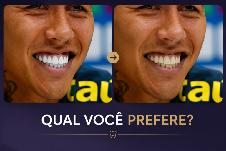 Paciente com sorriso natural após planejamento da cor ideal da faceta em Campinas na Freitas Odontologia.