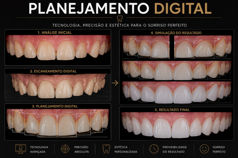 Planejamento digital do sorriso em Campinas com simulação do resultado na Freitas Odontologia.