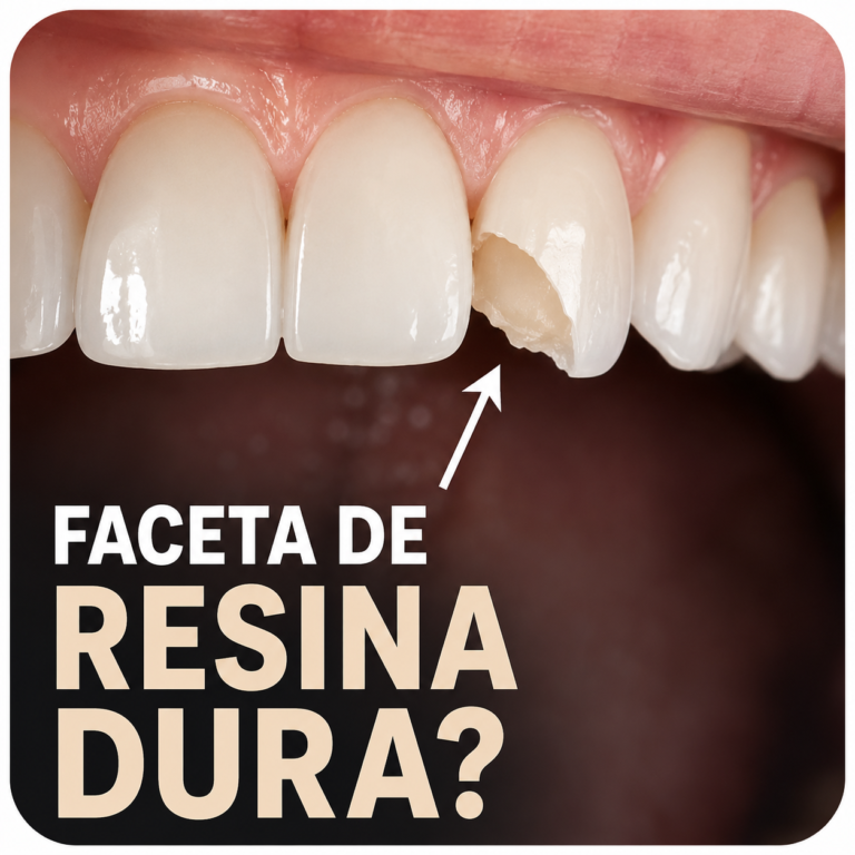 Paciente em avaliação estética para entender se faceta de resina é indicada e qual a durabilidade do tratamento